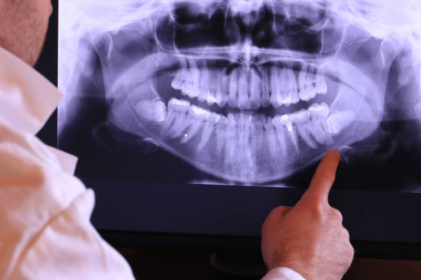 Best Emergency Treatment for Toothache in Lamont, MI